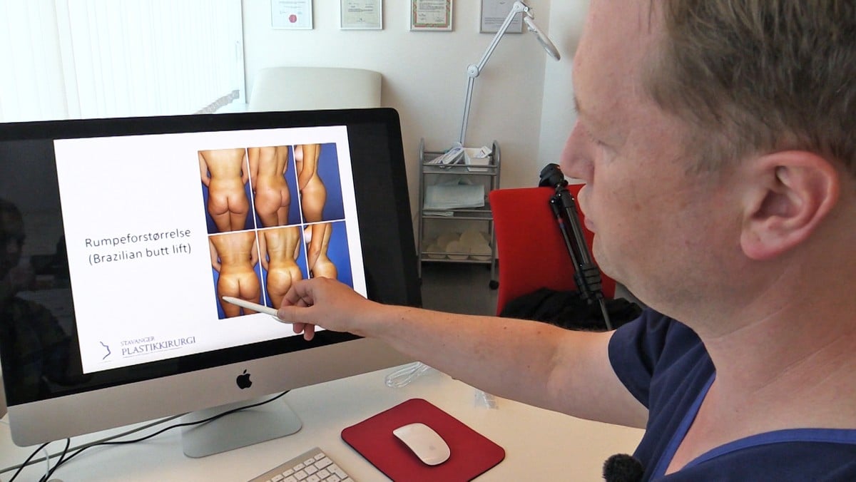 Braziliansk-buttlift-kirurg